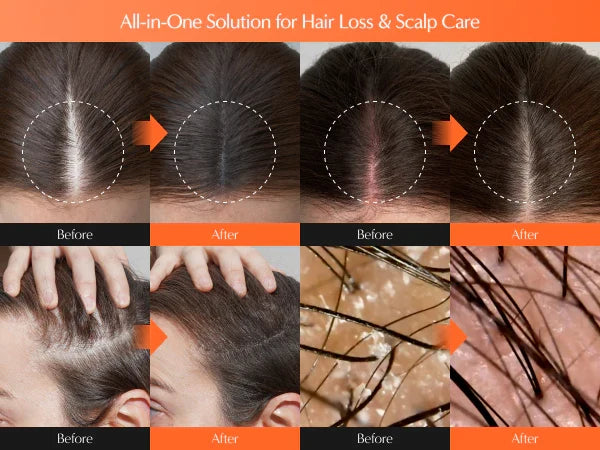 Lilyeve Grow:turn Hair Serum with Brush