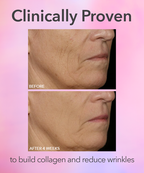 Dr. Dennis Gross DRx SpectraLite™ FaceWare Pro