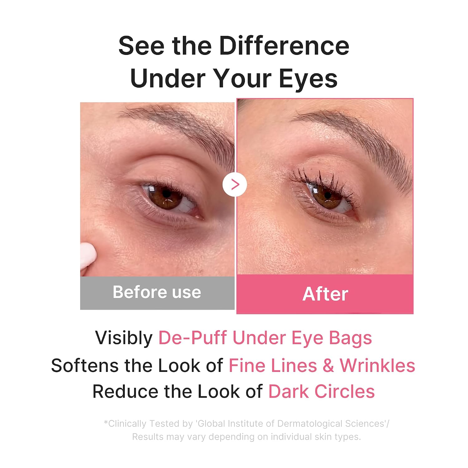 Medicube Collagen Hydrogel Eye Patch - 1 par