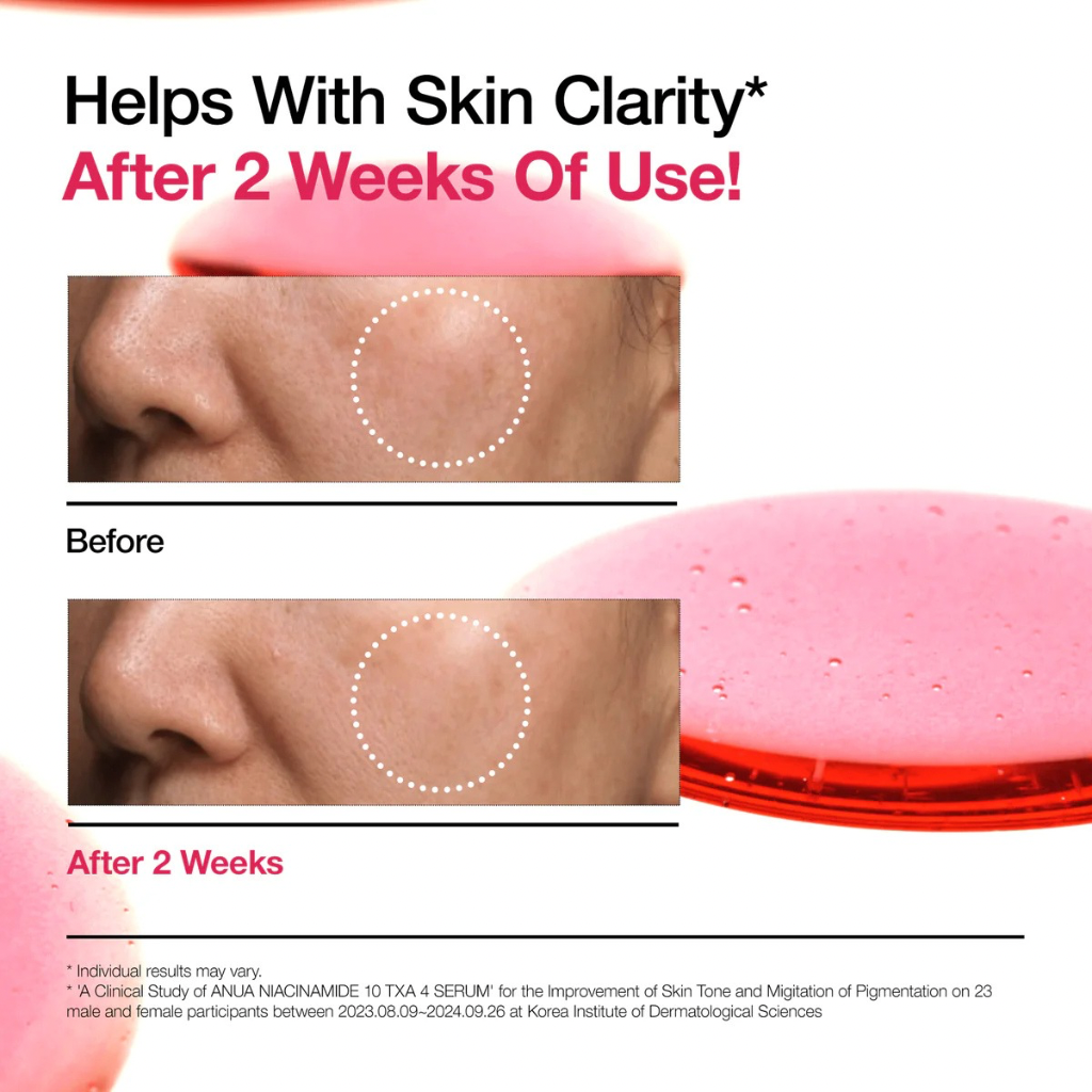Niacinamide 10 TXA 4 Serum for Brightening and Dark Spots