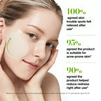 Anua Azelaic 10 Hyaluron Redness Soothing Pad