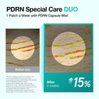 Anua PDRN Collagen Melting Patch for Neck