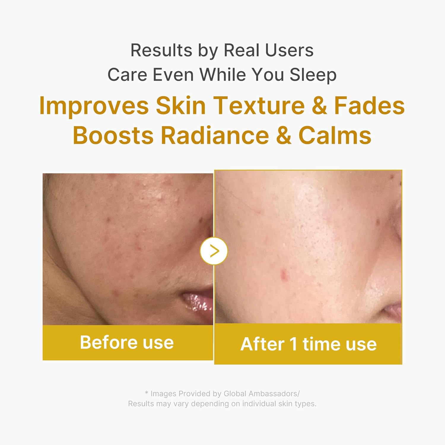 Medicube Kojic Acid Turmeric Night Wrapping Mask