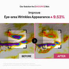 Mediheal Retinol Lifting Capsule Eye Patch