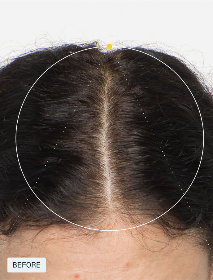 Nutrafol Women Hair Growth Nutraceutical