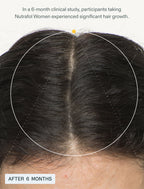 Nutrafol Women Hair Growth Nutraceutical