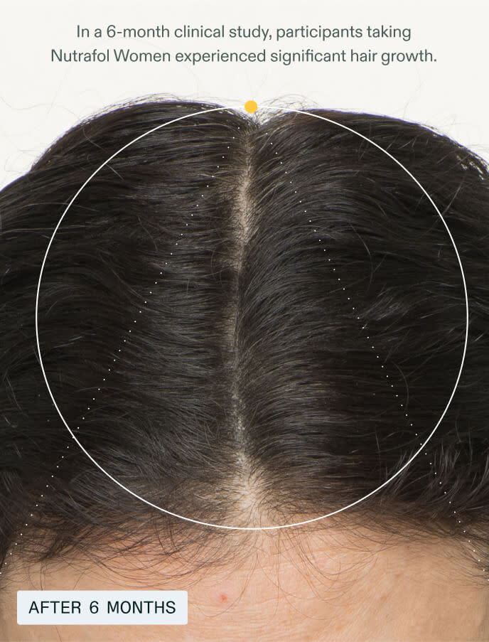 Nutrafol Women Hair Growth Nutraceutical